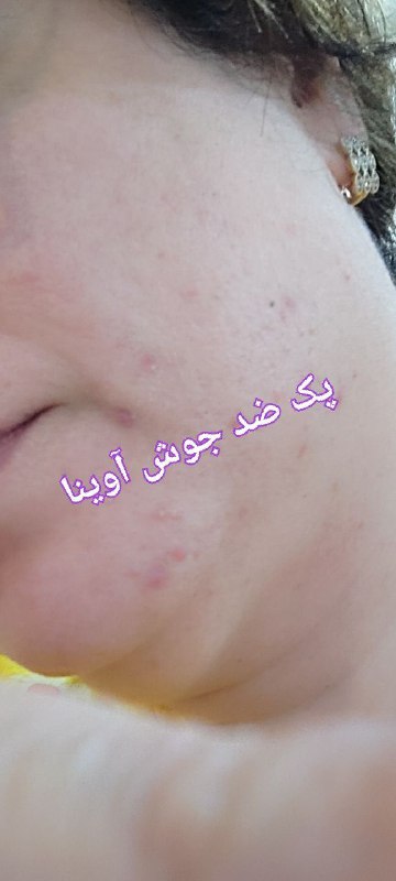🎀خانومانه🎀: رسانه پست