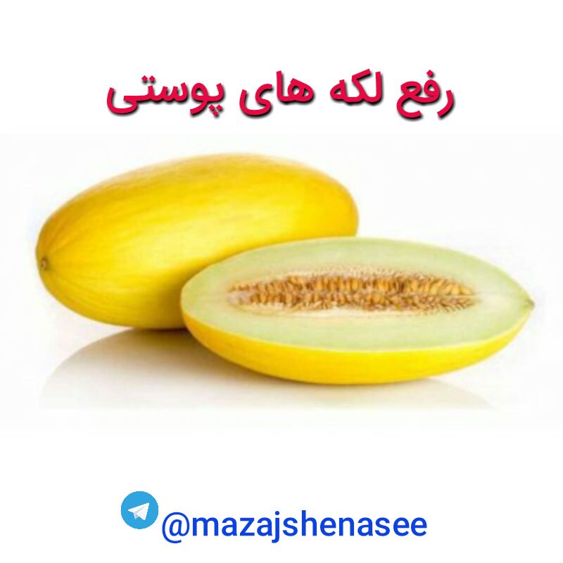 درمانگاه طب اسلامی گیاهی شفا: 🔶رفع لک‌های مقاوم به درمان توسط #خربزه♻ قرار دادن قسمت‌ داخلی #پوست_خربزه یا طالبی روی موضع کک و مک یا لکه‌های صورت به م