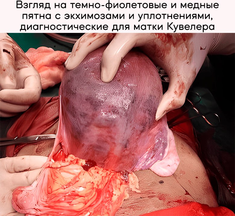 Иллюстрация к посту канала Кратко о заболеваниях