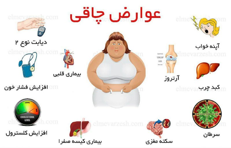 بدنسازی بانوان 👑BODYBUILDING👑: ❇️عوارض چاقی در👆 تصویر✅چاقی را یک بیماری بزرگ بدانیم چرا که عامل اصلی ایجاد بیماری هاست@Bodybuilding2021