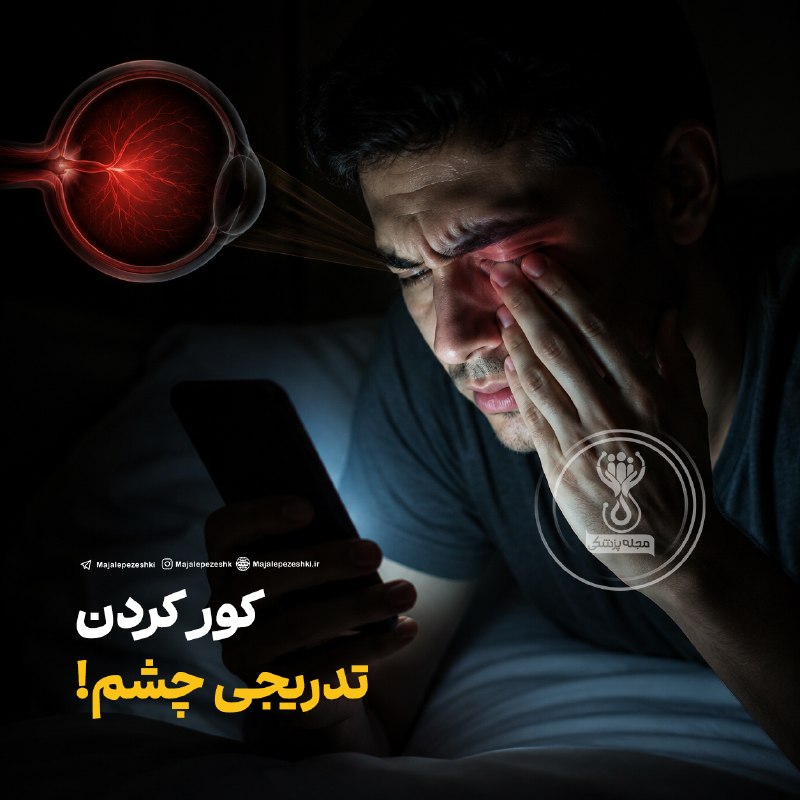 مجله پزشکی: کور کردن تدریجی چشم!استفاده از موبایل در محیطهای تاریک، بهخصوص قبل از خواب، میتواند باعث افزایش فشار روی چشمها، خشکی