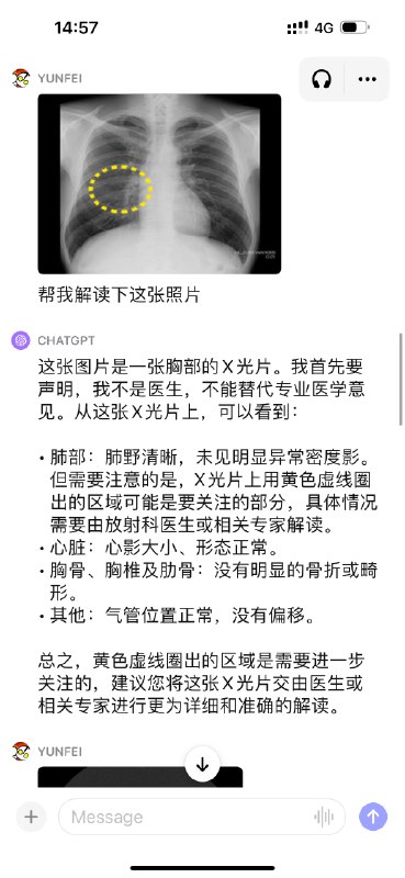 9个GPT-4V 用例：1、菜单翻译（其实甚至没文字只有菜品图都没问题）2、随身导游，逛博物馆时会很好用3、厨房助力，拍冰箱或者菜市场的照片让ChatGPT推荐做什么4、家装设计师，拍张家里的照片就可以获取装修建议5、穿搭建议，拍个全身照可以获得穿搭建议6、看手相7、X光片解读8、CT扫描解读9、安检机的X光线图像也能解读，用来辅助人工理解应该也有机会很快落地9个GPT-4V 用例：1、菜单翻译（其实甚至没文字只有菜品图都没问题）2、随身导游，逛博物馆时会很好用3、厨房助力，拍冰箱或者菜市场的照片让ChatGPT推荐做什么4、家装设计师，拍张家里的照片就可以获取装修建议5、穿搭建议，拍个全身照可以获得穿搭建议6、看手相7、X光片解读8、CT扫描解读9、安检机的X光线图像也能解读，用来辅助人工理解应该也有机会很快落地