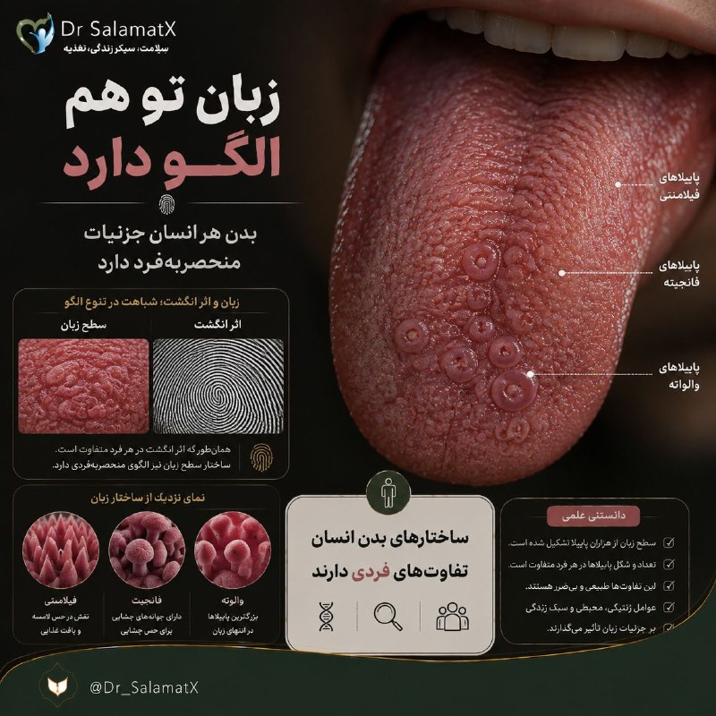 🍎 رسانه دکتر سلامت 🍏: ✔️ اثر انگشت زبان هم مثل اثر انگشت انسان منحصر‌به‌فرد است؟👅 ساختار زبان هر فرد شامل ویژگی‌های آناتومیکی متفاوتی است؛ اما