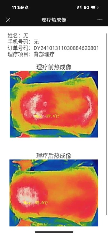 体验了一下机器人🤖按摩，设备应该来自思灵机器人公司，说一下体验：1. 机械臂🦾的按压力度唯一，导致触碰到脊骨等位置时，非常生硬的按压，体感很不舒服；（服务人员说产品正在换代升级，第二代产品会在11月底上线，目前正在调试阶段）2. 机械臂的运动轨迹非常单一，一直在画圈，中途画的我都恶心了；3. 探头的热度，在涂抹了精油后，探头的不断摩擦致使温度升高，需要人工手动降温