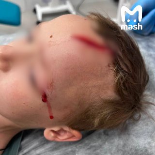 На внука Дарьи Донцовой напала собака у его дома в Подмосковье — огромный пёс набросился на ребёнка и стал кусать его за голову.7-летний мальчик Саша играл у ворот дома в селе Дубцы, где живёт его семья. Мимо, по словам писательницы, проходил сосед Алексей