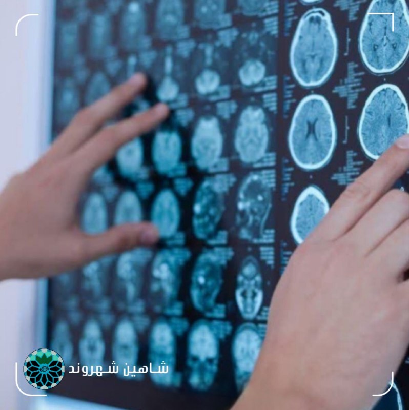 شاهین شهر وند: 📌 هوش مصنوعی برای اولین بار دست به تیغ جراحی شد 🔹برای اولینبار در جهان، یک بیمار ۴۸ ساله بریتانیایی به نام «ریس هیبرت»