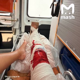 Ольгу Бузову госпитализировали с подозрением на перелом ноги. Завтра у неё запланирован концерт в Ростове, который могут отменить.Накануне певица вернулась из Стамбула. Сегодня утром она упала в душе у себя дома и приземлилась на колено. На завтра у неё за