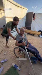 הוא איבד את רגלו ואת אחיו...ומפרנס את משפחתו ברגל אחת