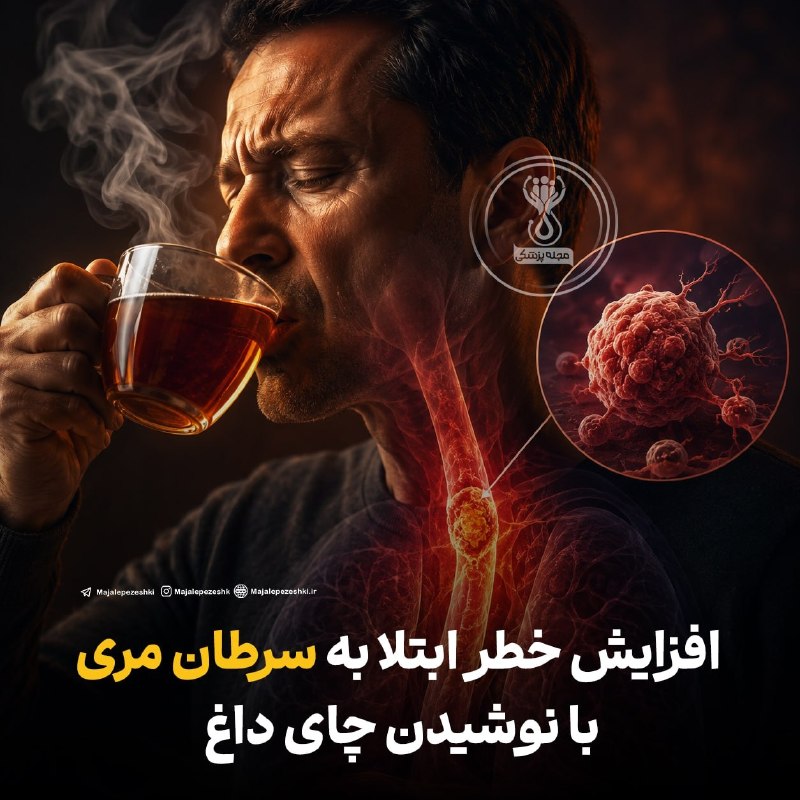پزشک تلگرام: افزایش خطر ابتلا به سرطان مری با نوشیدن چای داغ◽️رئیس مرکز تحقیقات سرطانهای گوارشی دانشگاه علوم پزشکی تهران اعلام کرد ک