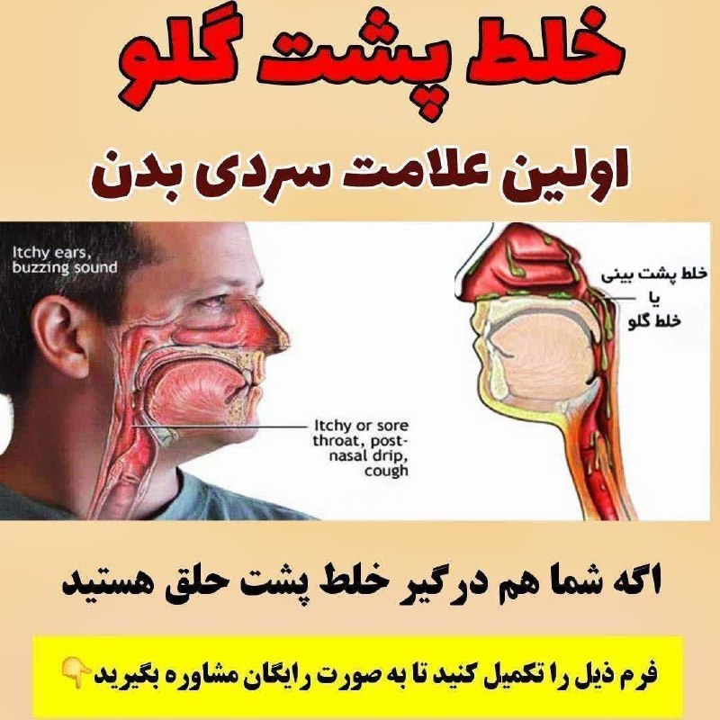کانال محله فرهنگی تاریخی قراملک: خلط پشت گلوریشه اصلی: بلغم در قسمت سر هست. هیچ آنتی بیوتیکی باعث درمان آن نمی شود،فقط باید بلغم سر را خارج کرد اگر خلط پ