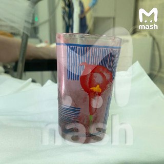 Трагическая подсечка от стакана зафиксирована в Уфе — во время празднования 23 февраля местный снайперски сел на стеклянного товарища. По его версии: поскользнулся и нечаянно упал тем самым местом на посудину.По данным Mash, Дмитрий отмечал День Защитника 