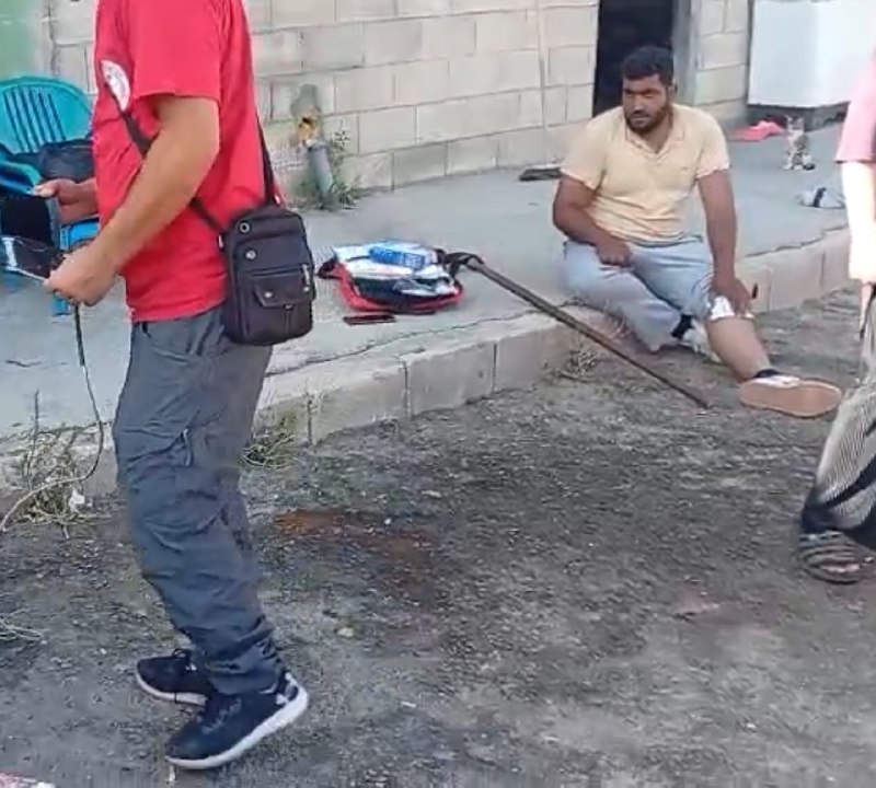 דחוף: צעיר נפצע; כתוצאה מתקיפת מתנחלים בביתו באזור ואדי סעיר מצפון לחברון.