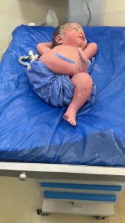Dr. Islam Aldea publishes a video of a baby who seems to have an unusual personality from the moment of birth!