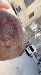 قوات الاحتلال تعتدي على شاب من مخيم قلنديا قبل إطلاق سراحه