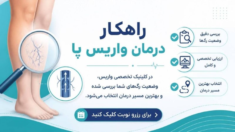 مجله پزشکی: عنوان: از واریس پا خلاص شویدتوضیح: درمان واریس با روش‌های نوین و کم‌تهاجمی، زیر نظر پزشکان متخصص@VarisHamrahBothttps://j