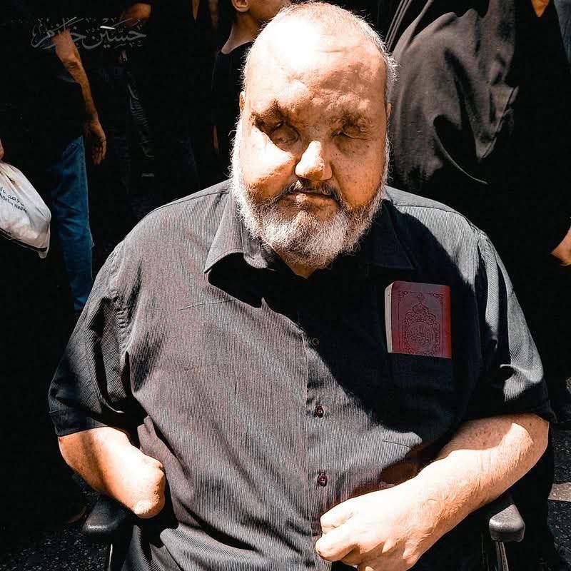 [ خمینیون ] إنا على العهد✌️: خبردار شدم مدتی قبل حاج #حسین_المقداد، مرد مجروح طریق بیت‌المقدس، پس سال‌ها مقاومت و جانبازی و تقدیم چشم‌ها، پاها و دستا