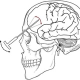|Архив|Lobotomy