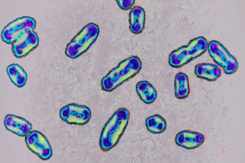 - 🇷🇺 New: There is a possible outbreak of pneumonic plague in Siberia, the Far Eastern region of Russia, after an accident in a BSL-3 laboratory