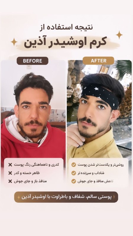 🌱🌱اندام جذاب🌱🌱: معجزه یعنی همین! 🪄تفاوت رو احساس میکنی؟ (بزن روی عکس تا دقیقتر ببینی) 🔍این همون نتیجهایه که از یک محصول حرفهای انتظا