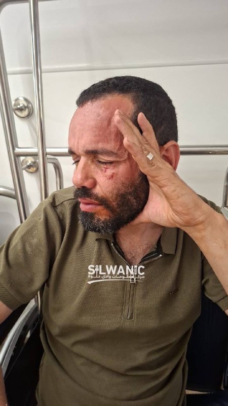הצעיר, טארק אל-בזלאמית (בן 45), סבל מכוויות בפניו כתוצאה מתנחל שתקף אותו וריסס אותו בגז בעת שעבר בעיירה שוע…