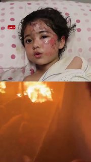 "The fire surrounded her while she slept. The grandfather of a Palestinian girl tells TRT Arab how his granddaughter survived a fire that claimed her mother's life, after she lost her father in a previous Israeli bombing.