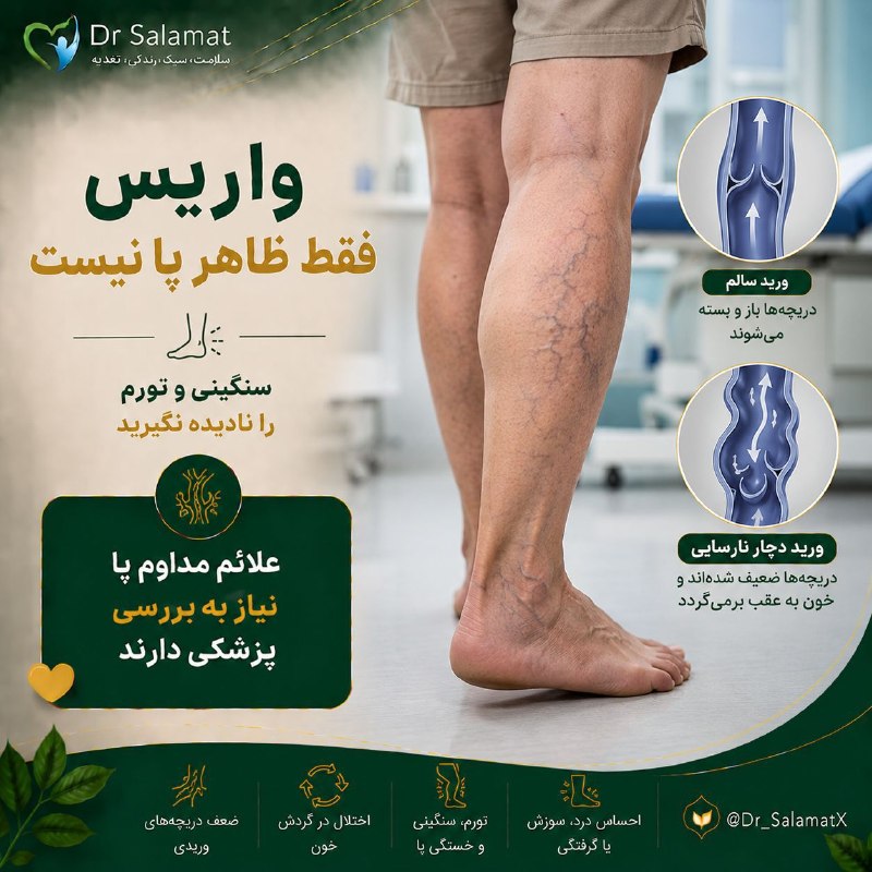 🍎 رسانه دکتر سلامت 🍏: ⚰ رگ‌های برجسته پا فقط مسئله زیبایی نیستند🦵واریس زمانی ایجاد می‌شود که رگ‌های سطحی پا بزرگ و پیچ‌خورده شوند. برخی افراد 