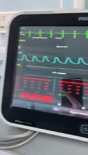 Думаю, что тема здоровья актуальна для всех родителей. Даша - практикующий хирург в Московской больнице, истинный фанат своей работы. Она совмещает... - изображение 8 - канале, подписчиков, найдете