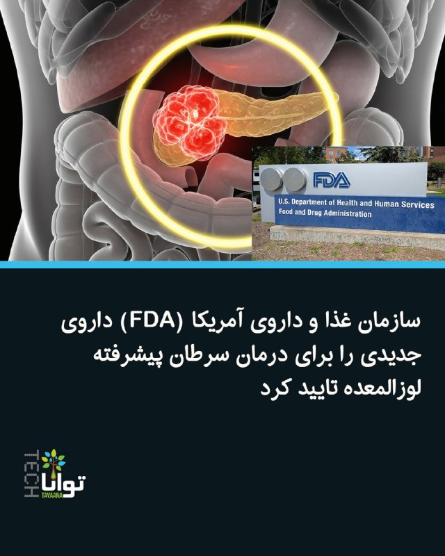 تواناتک Tavaanatech: سازمان غذا و داروی آمریکا (FDA) داروی جدیدی را برای درمان سرطان پیشرفته لوزالمعده تایید کردسازمان غذا و داروی آمریکا(FDA