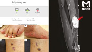 Антиваксеры, ликуйте, — вы были правы. Учёные из США доказали связь между вакциной Pfizer, Moderna и развитием онкологии. Исследования опубликовали на сайте медицинского журнала Oncotarget, но его тут же взломали и заблокировали. Предварительно, по указке 