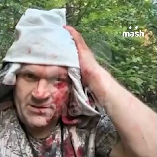 Е*ал я ваши охоты, разъе*ала меня медведицаОхотник выжил после неравного боя с медведицей в Новгородской области. Бурая прокусила ему голову, истерзала ноги и руки. Эмоции сильнейшего русского лесника — на видео.Киборг в камуфляже увидел пробегающую мимо х