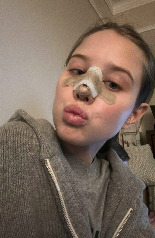 Избранница Лепса открыла правду о ринoplastике и проблемах с весом