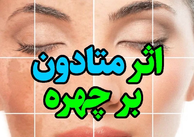 💚 زندگی و سلامتی💚: 🔴هشدار قرص متادون چه تاثیری بر چهره دارد ؟مشاهده ➡️➡️➡️