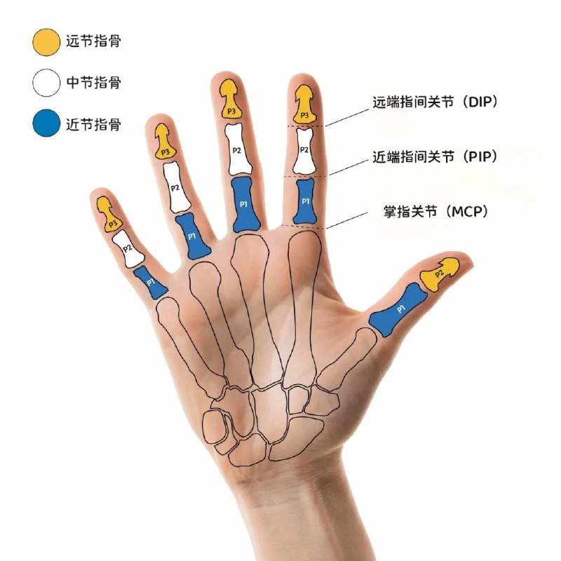 上肢假肢的「无感」革命+假肢对机器人灵巧手的关键时刻：Össur奥索收购Naked Prosthetics后，值得产品经理关注的三个ideaNP放弃电机与传感器，通过纯机械结构（肌腱驱动棘轮）实现90%生活场景覆盖