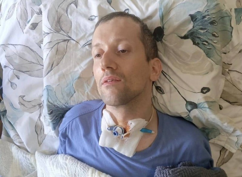 В 12 лет Магомед попал в ДТП и перенёс тяжёлую черепно-мозговую травму: перелом лобной кости, эпидуральную гематому. Было проведено оперативное лечение фото