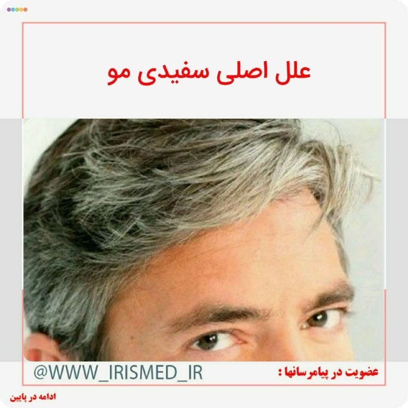 🍀 طب ائمه (درمانگاه سنتی)☘️: 🔴 علل اصلی #سفیدی_مو۱. غلبه سردی و تری بر مزاج فرد۲. یبوست شدید۳. غذاهای خشکیزا مانند کشک و پنیر و دوغ۴. امواج رادیواکت