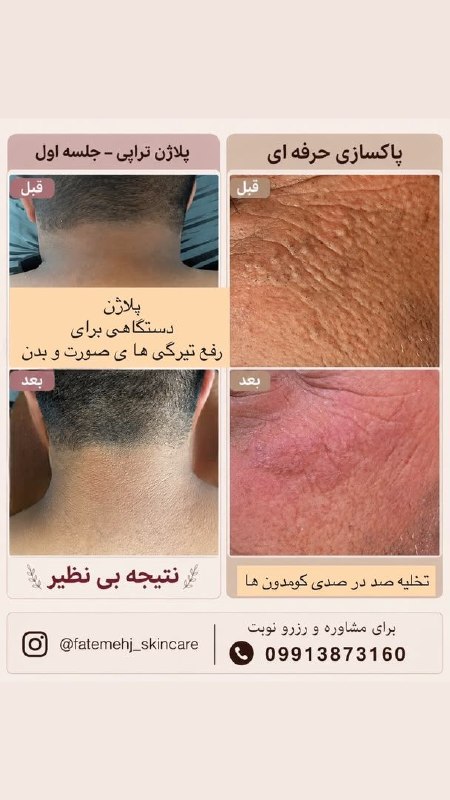 کانال خبری جابری️️️️️️: ✨ پوست، تخصص می‌خواهد؛ نه فقط زیبایی ظاهری ✨فشیال تخصصی، صرفاً شست‌وشو و ماسک نیست؛ هر پوست شرایط و نیاز متفاوتی دارد و 
