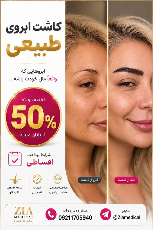 💋سالن زیبایی💅: ❌❌شرایط ویژه کاشت ابرو (تخفیف ۵۰٪ تا پایان مرداد)❌❌✅✅فرصت ویژه کاشت ابرو با شرایط پرداخت اقساطی✅✅✨ ابروهات کمپشته؟ جای