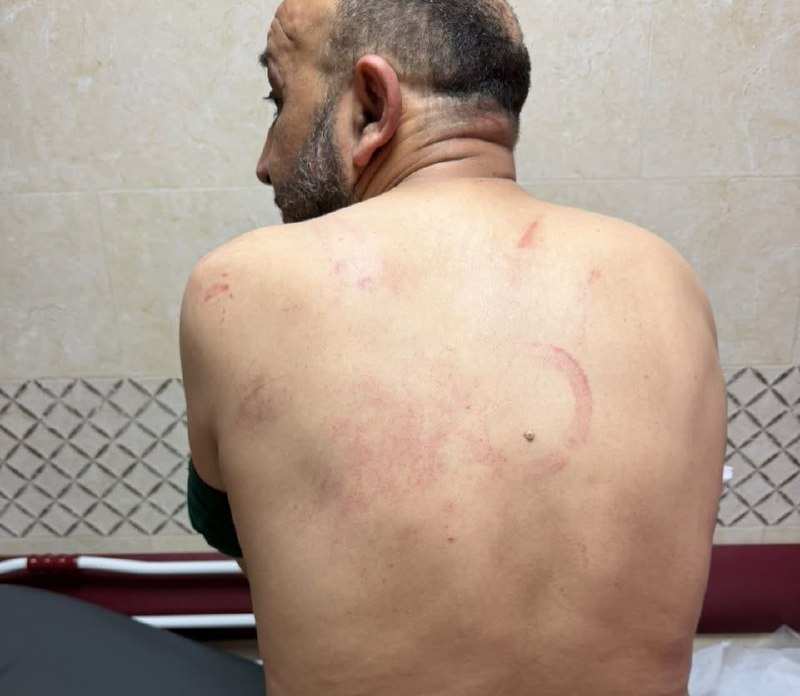 The activist Mazid Skaf was subjected to torture and assault by the PA's security services before his release.