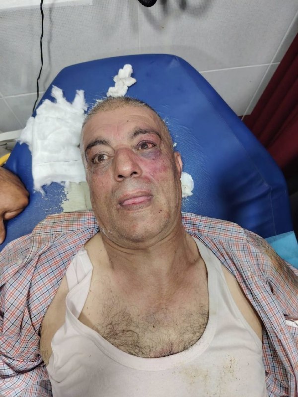 פיגוע אכזרי וברברי... השפעות הפיגוע של מיליציית המתנחלים על חבר עיריית בית פוריק, איברהים חתטבה באזור טנא א…