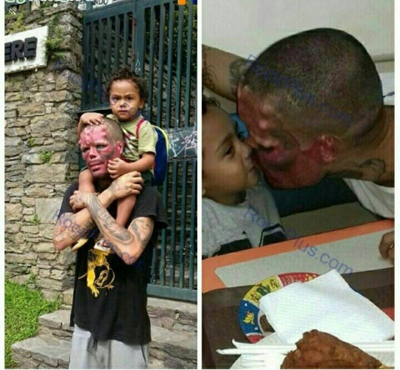 زندگـی شیرینـ 🌹Nana: وحشتناک ترین پدر دنیابچه اش عاشق یکی از شخصیت های فیلم های تخیلی شده،اینم رفته کلی هزینه جراحی کرده تا شبیه اون شخصیت بش