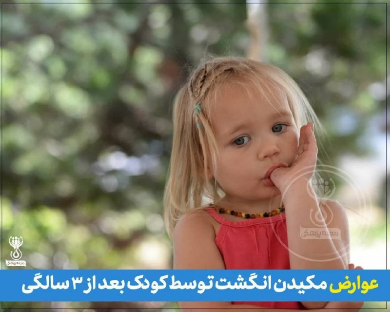 اخبار شهرستان گرمه: مکیدن انگشت توسط کودک بعد از 3 سالگی چه عوارضی دارد ؟▫️دندان ها ی کج ▫️ایجاد بیماری های عفونی ▫️در رشد کام تاثیر می گذار