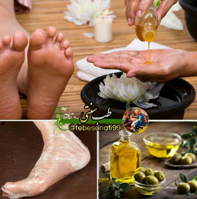 🍏طب سنتی🍏: اگر 1 ماه هرشب کف پا را با روغن زیتون چرب و در پلاستیک تا صبح بپوشانید 27 مرض را درمان میکنید ✔️▫️رفع سفیدی موها▫️پوکی ا
