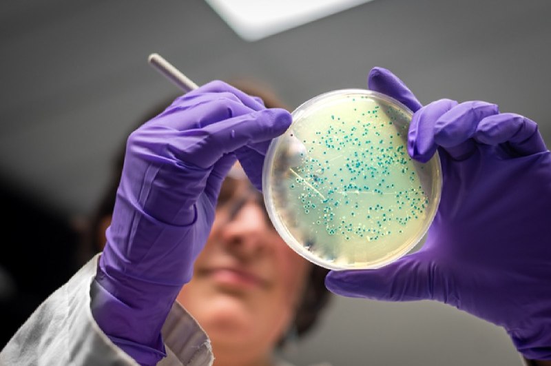 Bacteria, פטריות ו-"בליסקס" - AiF על מיקרואורגניזמים החיים בתוך אדם ועל השפעתם - "Obelisks" בתוכנו. אילו יש…