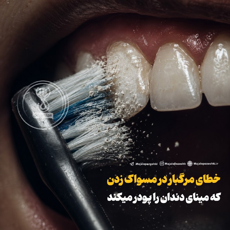 🗣 خبرهای داغ مجازی ✨️: خطای مرگبار در مسواک زدن که مینای دندان را پودر میکند!⚠️مسواک زدن افقی و پرفشار، مخصوصاً با مسواک زبر، می‌تونه باعث سایش