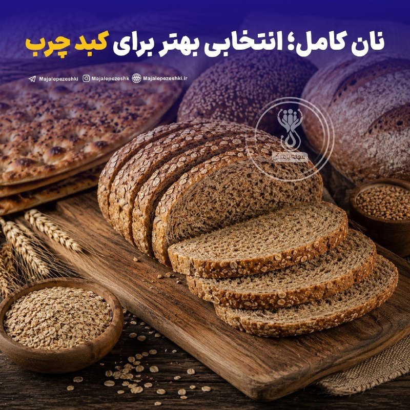 💞پندانه💞: نان کامل؛ انتخابی بهتر برای کبد چرب!◽️نانهای سبوسدار و تهیهشده از آرد کامل، به دلیل فیبر بالا و کمک به کنترل قند خون،