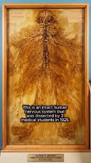 A complete human nervous system preserved as a single specimen, dissected by two medical students over 1,500 hours in 1925–1926.