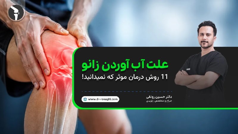 دکتر حسین رونقی متخصص جراحی ارتوپدی: علت آب آوردن زانو چیست + 11 روش درمان موثرتجمع مایع زانو که در زبان عامیانه به آن آب آوردن زانو می‌‌گویند، یکی از مشکلات