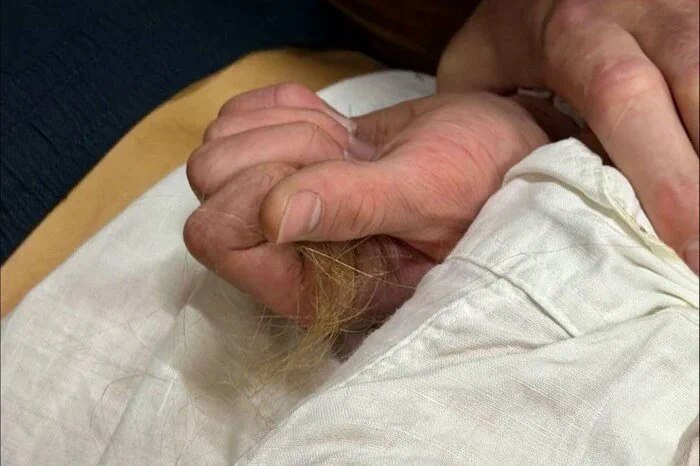 בקייב, נער בן 17, שאמו הזמינה אליו אמבולנס עקב חשד להרעלת סמים, תקף רופא ותלש גוש משערה. שומרים של מתחם מגו…