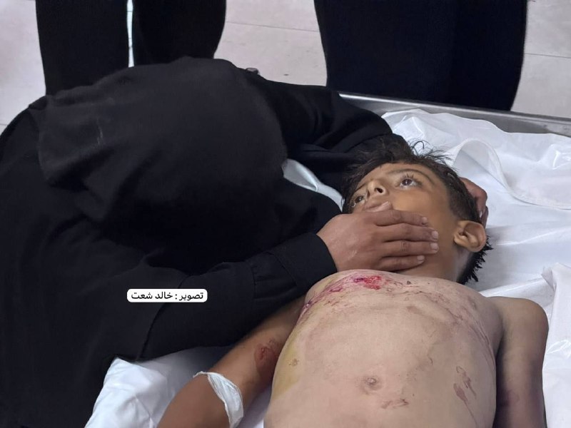 قوات الاحتلال تقتل طفلاً برصاصها في منطقة بئر 19