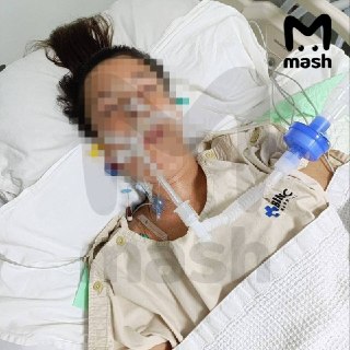 Умерла российская туристка, которая отравилась балийским вином и впала в кому после отдыха в Индонезии. Это уже второй летальный случай.Аня из Сочи провела в коме 22 дня. Врачи боролись за её жизнь, но два обследования показали полное отсутствие кровоснабж